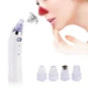Вакуумный очиститель для чистки пор лица с 4 насадками Derma suction DS Vacuum 19 х 4,5 см, 2 скорости, от 2 батареек AA, белый - изображение 2