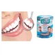 Знімні вініри для зубів Perfect Smile Veneers за відсутності або нерівності зубів - зображення 2