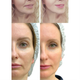 Микрострумовый лифтинг-массажер для лица MEDICA+ Skin Lifting 7.0 White (EMS, LED) - изображение 8