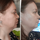 Микрострумовый лифтинг-массажер для лица MEDICA+ Skin Lifting 7.0 Pink (EMS+LED) - изображение 8