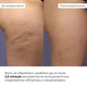 Антицеллюлитные моделирующие обертывания для тела с ниацинамидом Hillary Niacinamide Cold Slim HI-01-531 - изображение 4