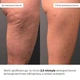 Набір антицелюлітних розігрівальних обгортань Hillary Heating Anti-Cellulite Wrap Set K-11-672 - зображення 2