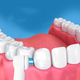 Насадка для електричної зубної щітки Oral-B Power Tip Care IP-17A для брекетів 4 шт - зображення 3