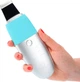 Ультразвуковий скрабер для чищення обличчя Medica+ Vibroskin 8.0 [79715] - зображення 10