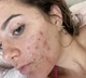 Очищающий эксфолиант с салициловой кислотой Panoxyl Clarifying exfoliant - изображение 2