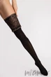 Панчохи в горох з широкою коронкою Fiore Notte 40 den O4116 4 Nero/Gold - зображення 3