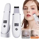 Ультразвуковий скрабер для шкіри ultrasonic skin cleaner gml-07, апарат для обличчя, лопатка для видалення чорних крапок, пілінг лопаткою, очисник пор, масажер для підтяжки обличчя, білий - зображення 6