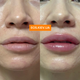 Інтенсивний плампер для губ з мікроголками VT COSMETICS Reedle Shot Lip Plumper Expert 4,3 г - зображення 3