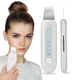 Портативный ультразвуковой скрабер Beauty Effect WAU-55 EMS + ионизация - изображение 2