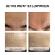 Secret Strips Anti-Wrinkle Smile Line Patches — пластыри от морщин на лбу с сывороткой для лифтинга и обновления кожи, 10 шт. + 8 мл - изображение 3