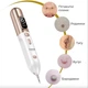 Электрокоагулятор Swan Beauty Smart Pen S60, портативная ручка для удаления папиллом, бородавок и сосудистых звездочек, для устранения рубцов постакне, золотистый - изображение 3