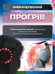 Электрический массажер для колена, локтя и плеча 3в1 беспроводной с подогревом и вибрацией, инфракрасный прогрев, LED дисплей - изображение 3