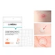 Гидроколоидные патчи Lanbena Acne Pimple Patch 25 шт от прыщей и угрей против акне дневные - изображение 2