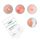 Гидроколлоидные патчи Lanbena Acne Pimple Patch Night Use 28 шт от прыщей и угрей против акне ночные - изображение 2