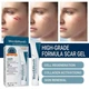 Силиконовый гель от рубцов и шрамов West&Month Silicone Scar Gel 20 г для заживления и выравнивания кожи (scar-gelwest) - изображение 2