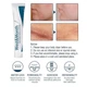 Силиконовый гель от рубцов и шрамов West&Month Silicone Scar Gel 20 г для заживления и выравнивания кожи (scar-gelwest) - изображение 4