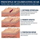 Силиконовый гель от рубцов и шрамов West&Month Silicone Scar Gel 20 г для заживления и выравнивания кожи (scar-gelwest) - изображение 5
