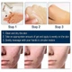 Силиконовый гель от рубцов и шрамов West&Month Silicone Scar Gel 20 г для заживления и выравнивания кожи (scar-gelwest) - изображение 9