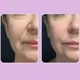 Сыворотка-филлер с пептидами Medi-Peel Eazy Filler Ampoule 30 ml - изображение 3