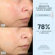 Набор для микротоковой терапии NuFACE Trinity+ and Effective Lip and Eye Attachment Set - изображение 9