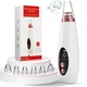 Апарат для глибокого вакуумного чищення пор обличчя Dermal Multi-Functional Cleaning - зображення 5