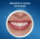 Отбеливающие полоски Crest 3D Professional Effects Whitestrips - изображение 5