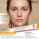 Третиноин гель 0,05% от акне 20г | Tretinoin gel USP 0.05 w/w A-Ret Menarini - изображение 2