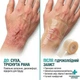 Пластир гідроколоїдний у рулоні 5 см × 5 м медичний для ран Medical-Grade Hydrocolloid Roll 21N x 16FT, Nantong YOJO - зображення 11