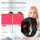 Смарт-часы MARSYU ET570 с ЭКГ Bluetooth звонки черный - изображение 5