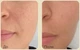 Крем против морщин с золотом и камелией Medi-Peel Premium Golden Camellia Wrinkle Cream 50 мл - зображення 5
