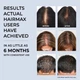 HAIRMAX Actonis™ Dual Action 18 лазерная расчёска для стимуляции роста волос (замена LaserComb Ultima 12) - изображение 6