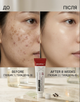 Крем освітлюючий проти пігментації MEDIPEEL Melanon X 2.0 30 ml (8809941825862) - зображення 2