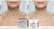 Крем для шиї та декольте MEDIPEEL Premium Collagen Naite Thread Neck 3.0 100 ml (8809941825688) - зображення 4