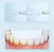 Ирригатор портативный MIJIA teeth flosser F300 полости рта для чистки зубов ирригатор бездротовой аккумуляторный для брекетов Oral irrigator - изображение 3