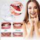 Многоразовые накладки на зубы Snap On Smile Veneers, универсальные виниры для зубов съемные, комплект на 2 челюсти, безопасные, белые - изображение 9