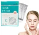 Пластырь от бородавок, натоптышей и папиллом Acne Patch, 72 шт, устраняют зуд и шелушение на коже, гидроколлоидный, лечебный - изображение 1