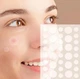 Пластырь от бородавок, натоптышей и папиллом Acne Patch, 72 шт, устраняют зуд и шелушение на коже, гидроколлоидный, лечебный - изображение 4