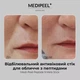 Стик антивозрастной для лица с пептидами Medi-Peel Peptide 9 Mela Stick 10 g - изображение 5