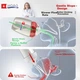 Бутылочка детская Hoag Anti Colic Nipple стекло антиколиковая 150 мл - изображение 4