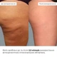 Антицеллюлитные липосомальные обертывания Hillary Anti-cellulite Bandage LPD'S Slimming HI-01-528 - изображение 4