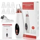 Вакуумный аппарат для чистки кожи лица Multi — Functional Cleaning - изображение 3