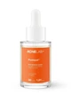 Сироватка для корекції слідів після акне ACNELAB+ Postspot Post Breakout Serum, 30 мл (52764056945008) - зображення 2