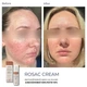 Успокаивающий крем BRADERM Rosac Cream, 30 мл 00-00000389 - изображение 4