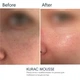 Деликатная пенка для умывания BRADERM Kurac Mousse, 100 мл 00-00000384 - изображение 3