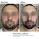 Увлажняющая эмульсия BRADERM Axatopic Cream, 250 мл 00-00000427 - изображение 2