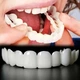 Знімні вініри Smile Veneers на дві щелепи, білі накладки на зуби для ідеальної усмішки - зображення 2