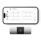 Персональный ЭКГ-монитор AliveCor KardiaMobile 6L, 6 отводов, AFib, 30 секунд, iOS Android - изображение 2