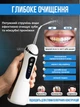 Ирригатор для полости рта 200 мл портативный аккумуляторный с 4 насадками Oral Irrigator, беспроводной с 3 режимами работы для ухода за зубами, деснами и брекетами Белый, AND-1-37-White - изображение 5