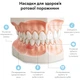 Насадки к ирригатору RZTK Dental Jet - изображение 9