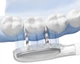 Насадки для электрической зубной щетки Laifen ProSS Gum Care (30102-000140) - изображение 4